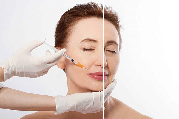 tiêm filler có ảnh hưởng gì không