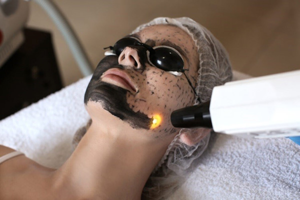 điều trị lỗ chân lông to bằng laser