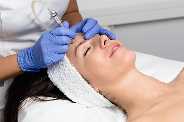 công dụng của microdermabrasion